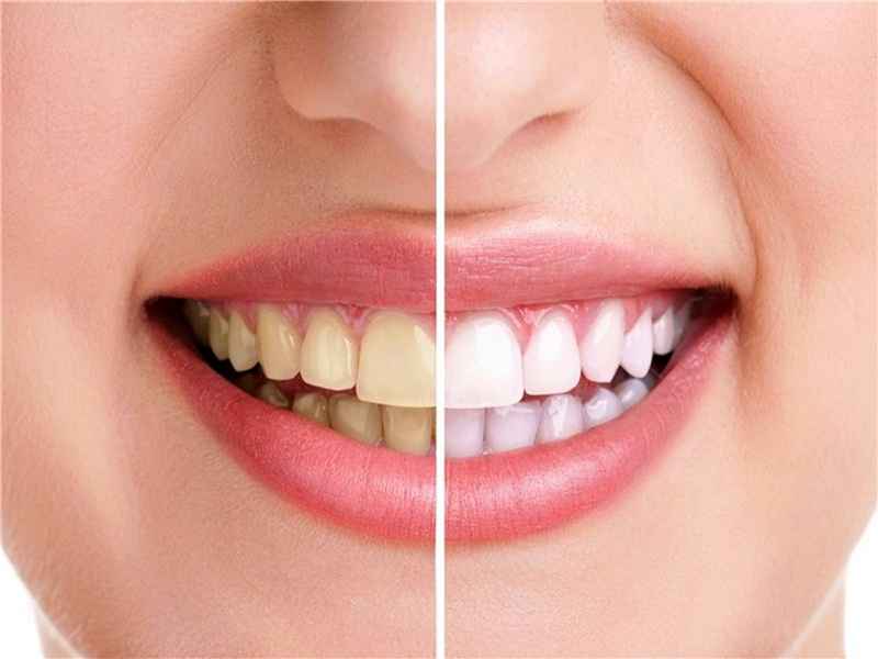 ترکیبات شیمیایی رایج در خمیردندان‌ها